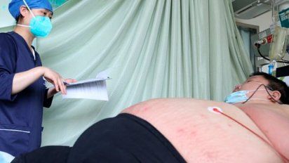 Hombre engordó 100 kilos tras pasar 5 meses en cuarentena