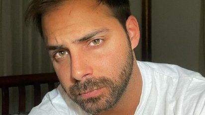 El implante capilar de Grego Rossello