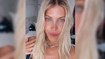 Cande Ruggeri se hizo un retoque en la cara y quedó en evidencia