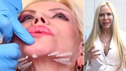 ¿Cuántas cirugías tiene Alejandra Pradón?