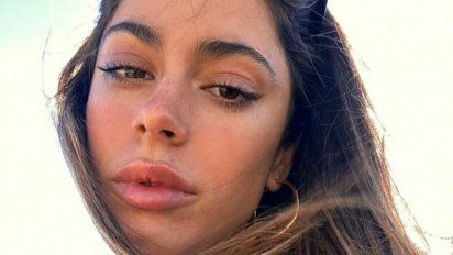 Tini Stoessel se hizo un retoque estético que causó polémica entre sus seguidores