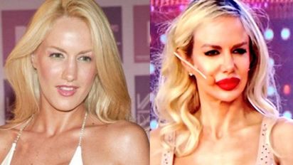 Luciana Salazar: ¿Cuántas operaciones se hizo?