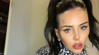 Cande Tinelli subió una foto mostrando el retoque facial que se hizo