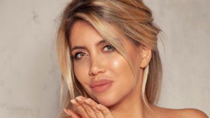 Wanda Nara habló sobre su cirugía de nariz