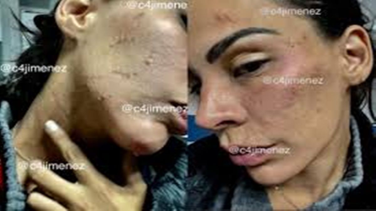 Televisa plantea despedir a Eleazar Gómez tras escándalo por golpear a su novia