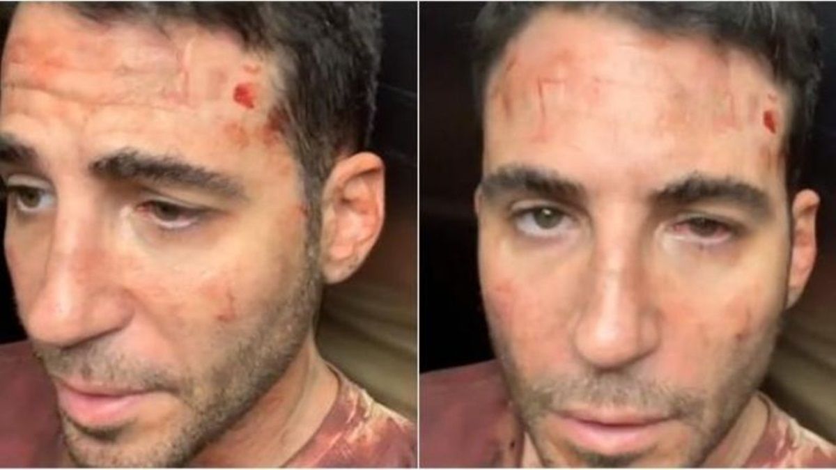 Desconcertante: Miguel Ángel Silvestre aparece con unas heridas en el rostro