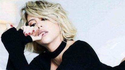 Wanda Nara habló sobre sus operaciones: 