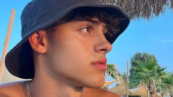Joven influencer perdió una pierna en 