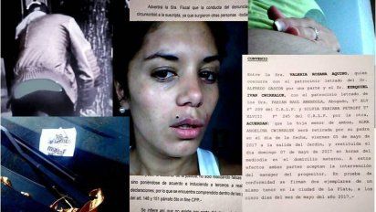 Expediente secreto: aparecen fotos de la ex de El Polaco, Valeria Aquino, golpeada