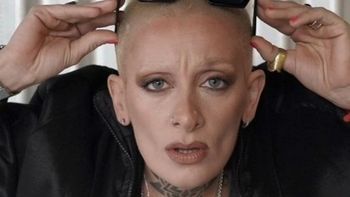 Furia de Gran Hermano se hizo un retoque estético en su cara y lo mostró en redes