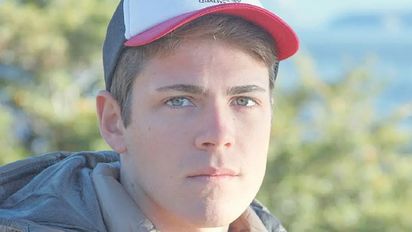 Marcos Ginocchio tuvo un accidente en el rostro y preocupó a sus fanáticos