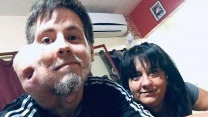 Impactante historia de joven con cáncer que lucha por vivir