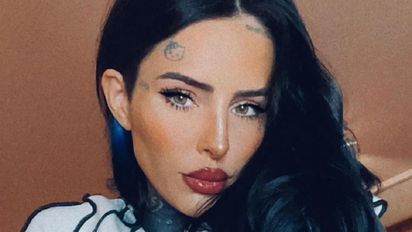 Cande Tinelli se hizo una rinoplastia