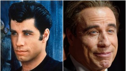 Famosos ¿estafados por sus cirujanos plásticos?