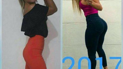 Comparan la cola 2016 con el modelo 2017 de Sol Pérez, y dicen que se la operó