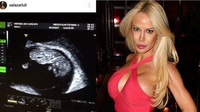 Luciana Salazar será madre; Alquiló un vientre y publicó la ecografía en Instagram: 