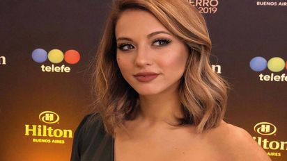 ¿Qué le pasó a Flor Vigna en el rostro?