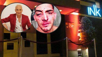 El boliche INK desmiente a Flavio Mendoza tras la golpiza que desfiguró a un bailarín