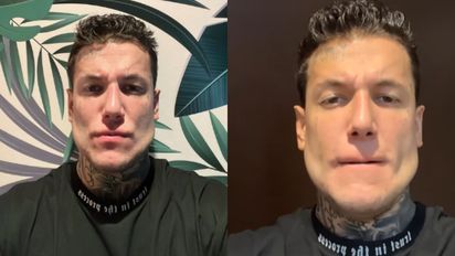 Alex Caniggia se hizo un significativo retoque estético: 