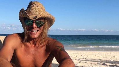 Claudio Caniggia se hizo un tratamiento estético en la cara