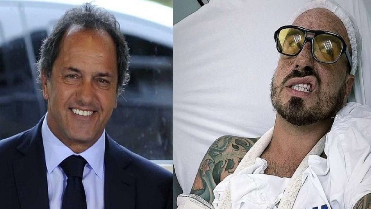 Daniel Scioli sorprendió a Fede Bal con un comentario tras su accidente