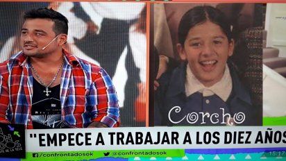 El drama de Corcho, ex Chiquititas: ''Me quemé con alcohol y perdí un ojo, espero un trasplante de córnea''