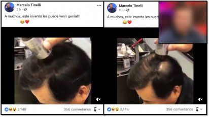 La divertida gastada de Tinelli a uno de sus participantes que se está quedando pelado