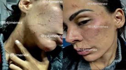 Televisa plantea despedir a Eleazar Gómez tras escándalo por golpear a su  novia - Telebajocero México | El Portal De Espectáculos Más Picante
