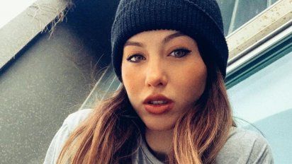 Flor Vigna ¿Perdió un diente? 