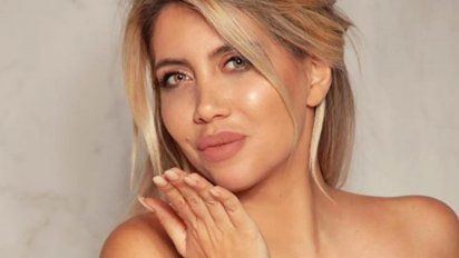 Wanda Nara y sus impresionantes cirugías