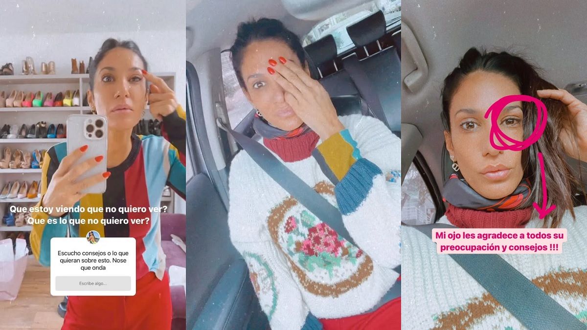 Silvina Escudero pidió consejos a sus fans para resolver un problema en su ojo