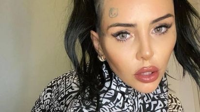 ¿Cuál es? Cande Tinelli mostró el tratamiento estético que más le gusta