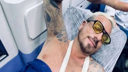 Fede Bal dio detalles de cómo fue su accidente en Brasil