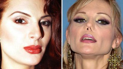 antes y despues: carmen campuzano y otras famosas con cirugias faciales
